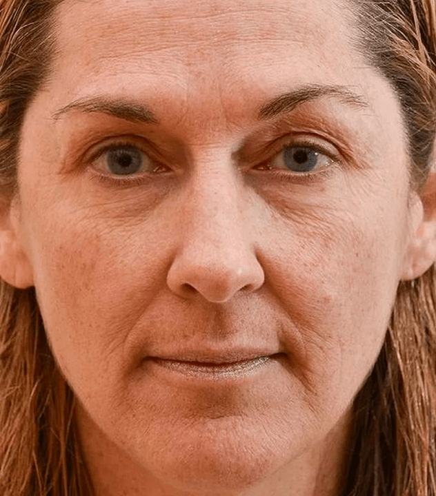 Moja twarz przed użyciem kremu eudalie