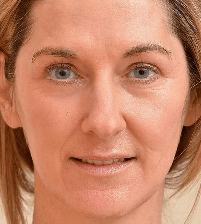 Wyglądam młodziej po użyciu Eudalie Cream